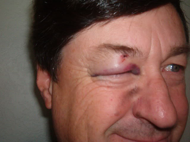 Name:  Prisoner07734004.jpg
Views: 610
Size:  31.5 KB